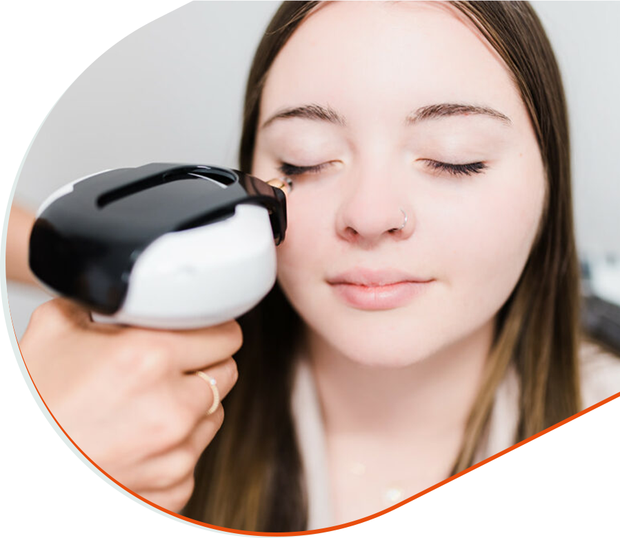 Intense Pulsed Light (IPL) treatment applied around the eye area