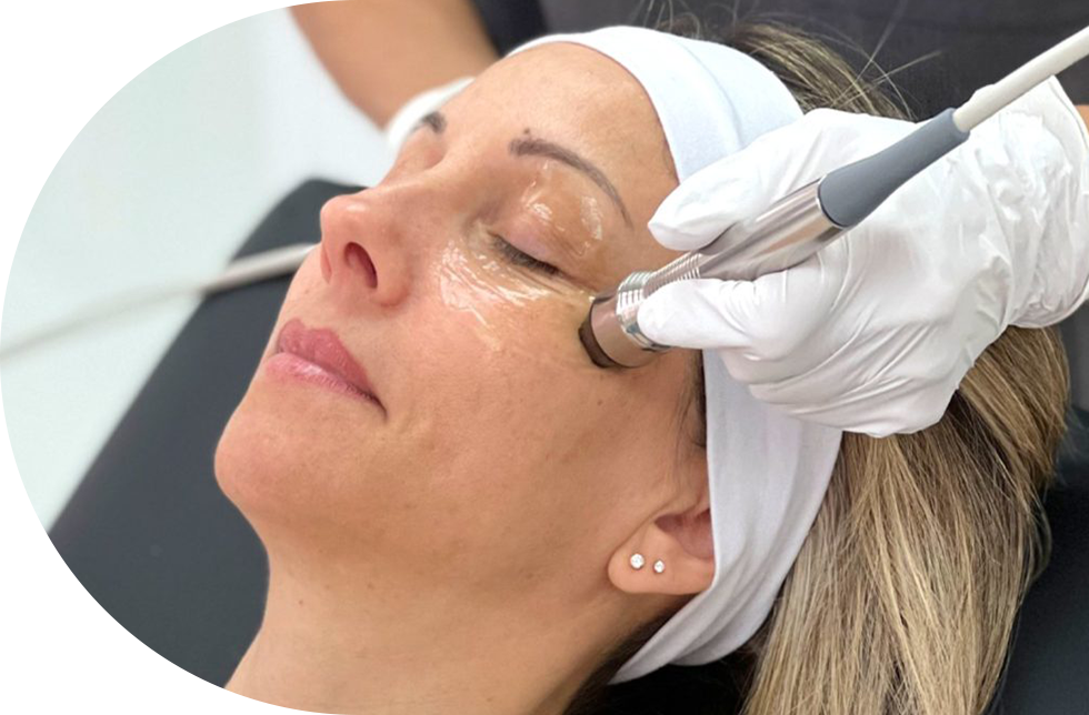 Eye contour treatment performed using radiofrequency therapy