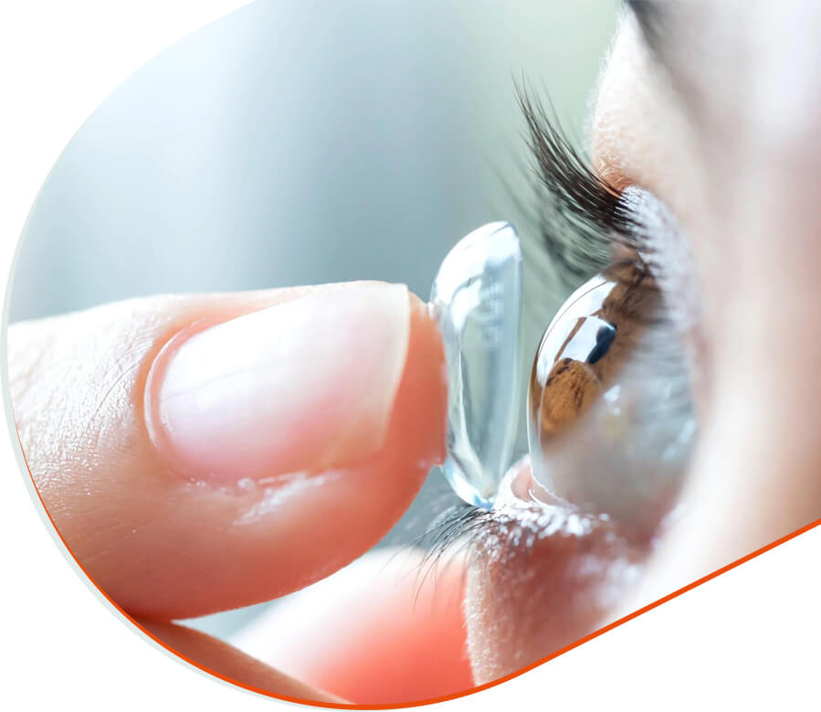 Applying a contact lens to the eye